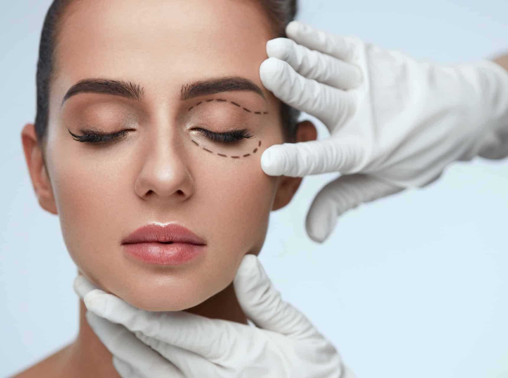 Rattraper une blépharoplastie ratée avec le Dr Raspaldo à Genève